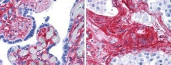 Biton Vi Collagen VI alpha 1 Antibody, Biotin, Novus Biologicals 50μg:Antibodies ...
